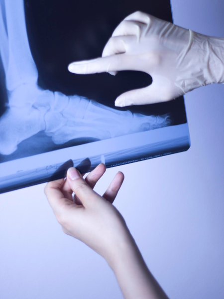 Cita con Traumatólogo en Irapuato